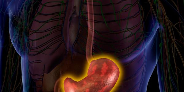 želudac i žgaravica